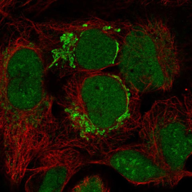 FAM171B Antibody in Immunocytochemistry (ICC/IF)