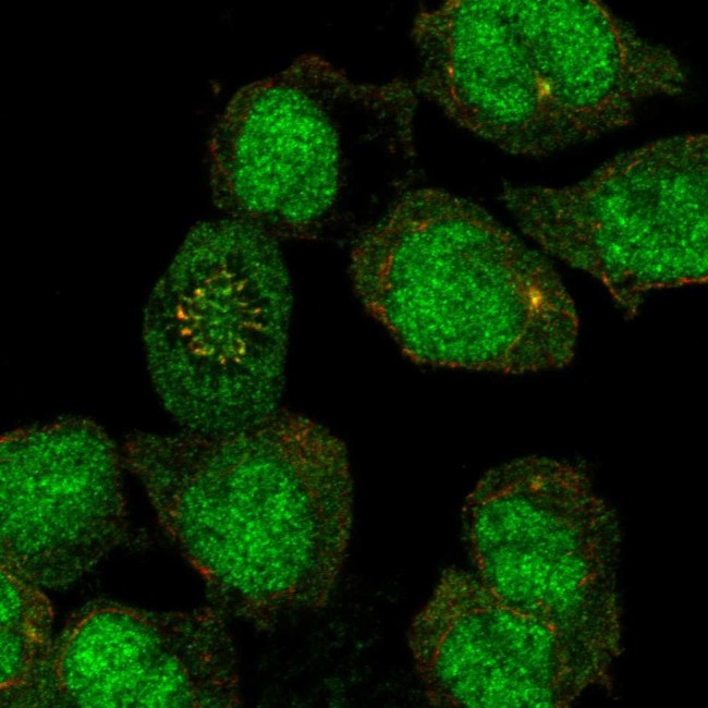 FANCE Antibody in Immunocytochemistry (ICC/IF)