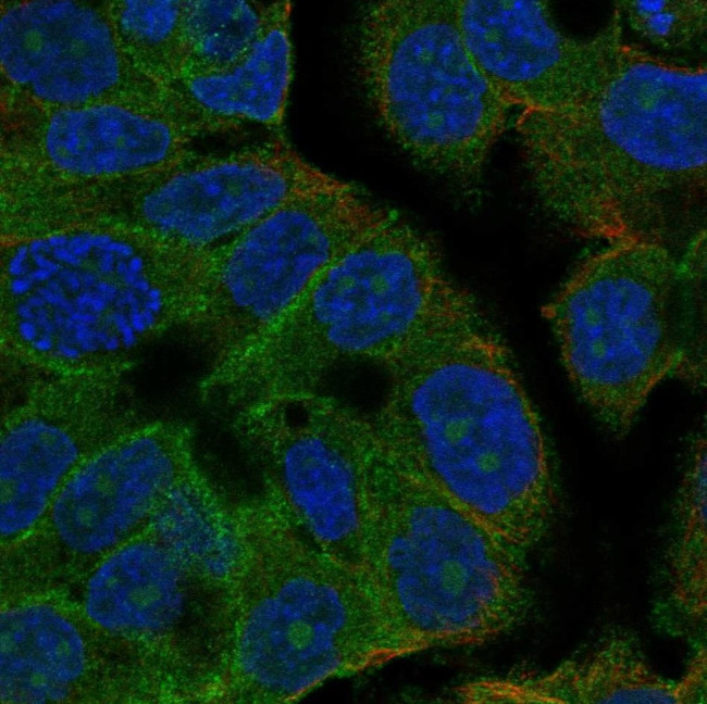 TMEM2 Antibody in Immunocytochemistry (ICC/IF)