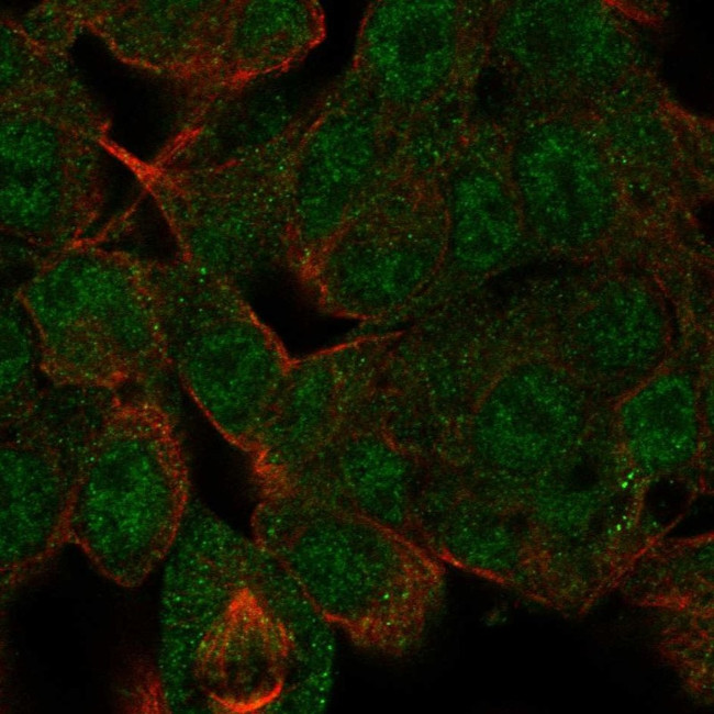 HDAC10 Antibody in Immunocytochemistry (ICC/IF)