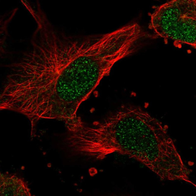 NME7 Antibody in Immunocytochemistry (ICC/IF)