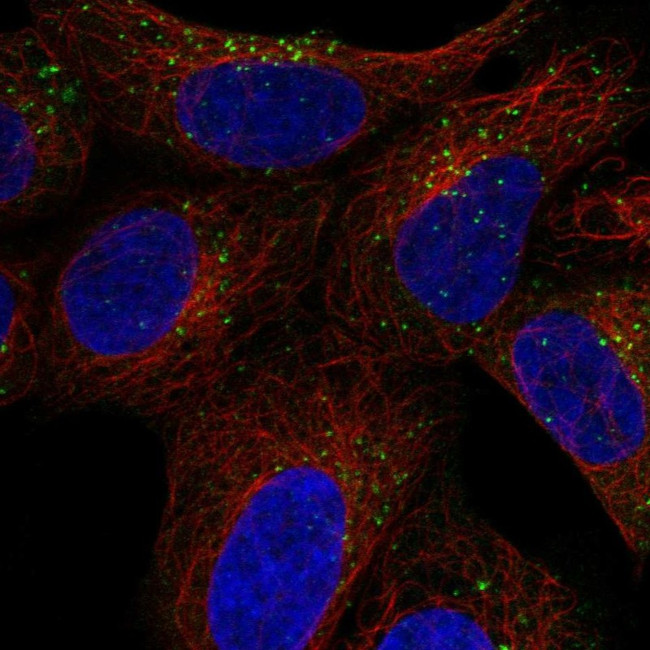 SNX27 Antibody in Immunocytochemistry (ICC/IF)