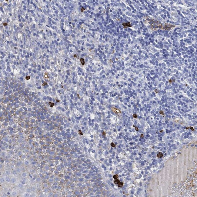 IGLV6-57 Antibody in Immunohistochemistry (Paraffin) (IHC (P))