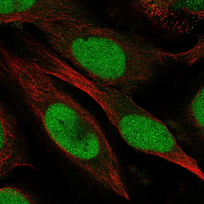 ZGRF1 Antibody in Immunocytochemistry (ICC/IF)