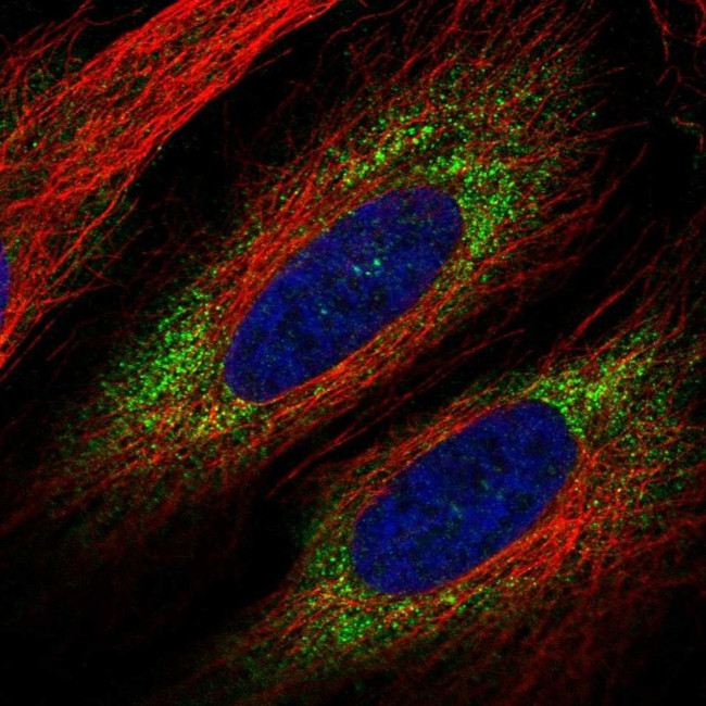 VWDE Antibody in Immunocytochemistry (ICC/IF)