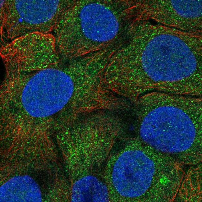 Profilin 3 Antibody in Immunocytochemistry (ICC/IF)