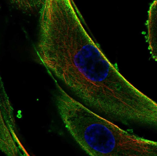 COL5A3 Antibody in Immunocytochemistry (ICC/IF)