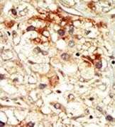 PCTAIRE2 Antibody in Immunohistochemistry (Paraffin) (IHC (P))