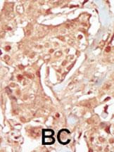 PCTAIRE3 Antibody in Immunohistochemistry (Paraffin) (IHC (P))