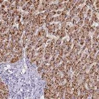 PCNX Antibody in Immunohistochemistry (Paraffin) (IHC (P))