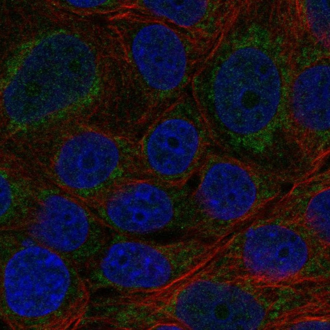 CYP11B2 Antibody in Immunocytochemistry (ICC/IF)