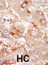 PRPF4B Antibody in Immunohistochemistry (Paraffin) (IHC (P))