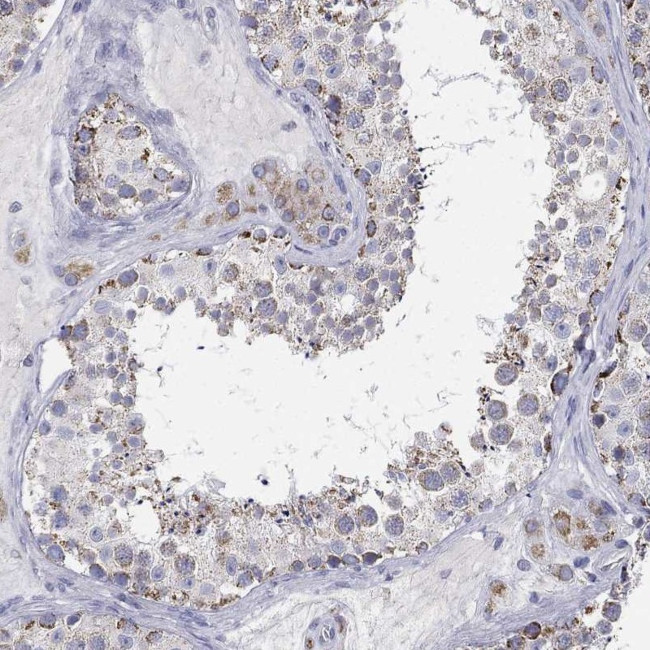MUM1 Antibody in Immunohistochemistry (Paraffin) (IHC (P))