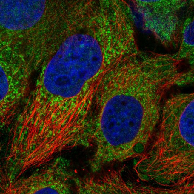 CDK5RAP1 Antibody in Immunocytochemistry (ICC/IF)