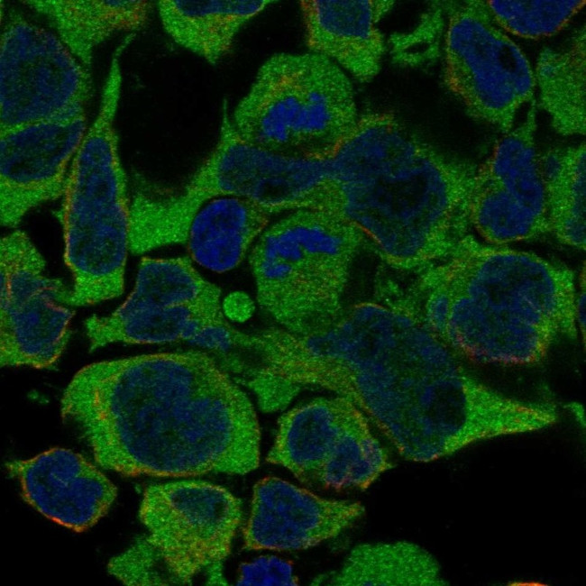 N4BP2L1 Antibody in Immunocytochemistry (ICC/IF)
