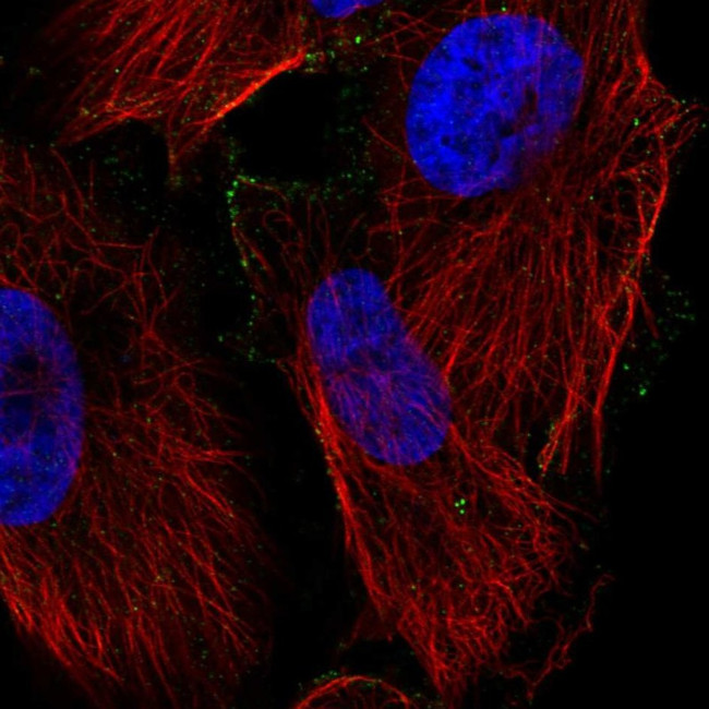PPAP2C Antibody in Immunocytochemistry (ICC/IF)