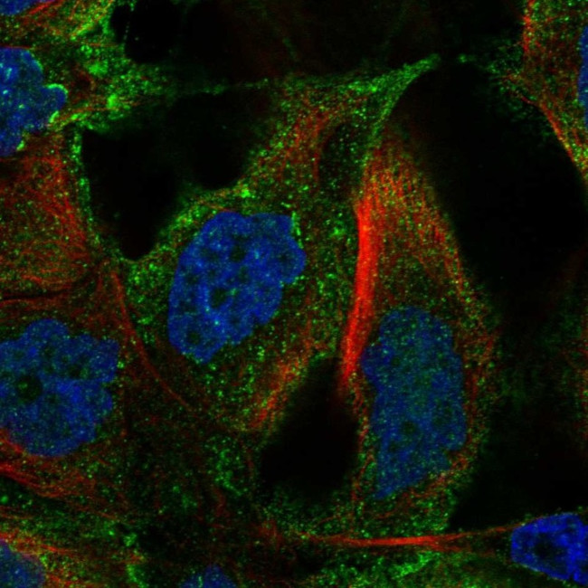 TM4SF18 Antibody in Immunocytochemistry (ICC/IF)