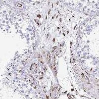 TMEM54 Antibody in Immunohistochemistry (Paraffin) (IHC (P))