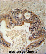 DYRK1A Antibody in Immunohistochemistry (Paraffin) (IHC (P))