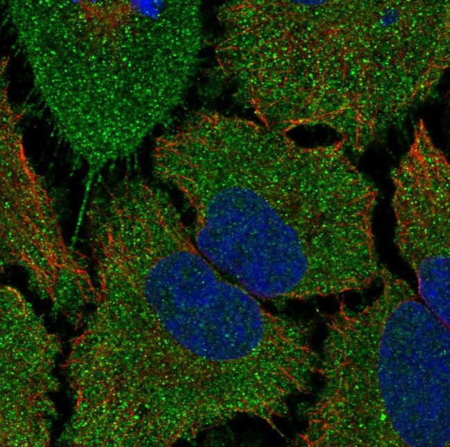 TMCO5A Antibody in Immunocytochemistry (ICC/IF)