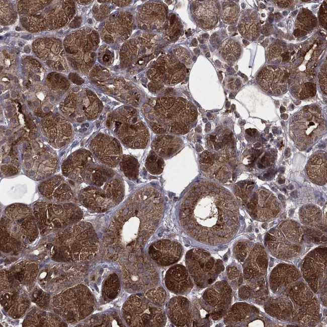 ZDHHC15 Antibody in Immunohistochemistry (Paraffin) (IHC (P))