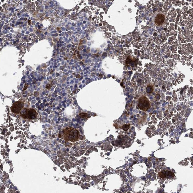 CTSW Antibody in Immunohistochemistry (Paraffin) (IHC (P))