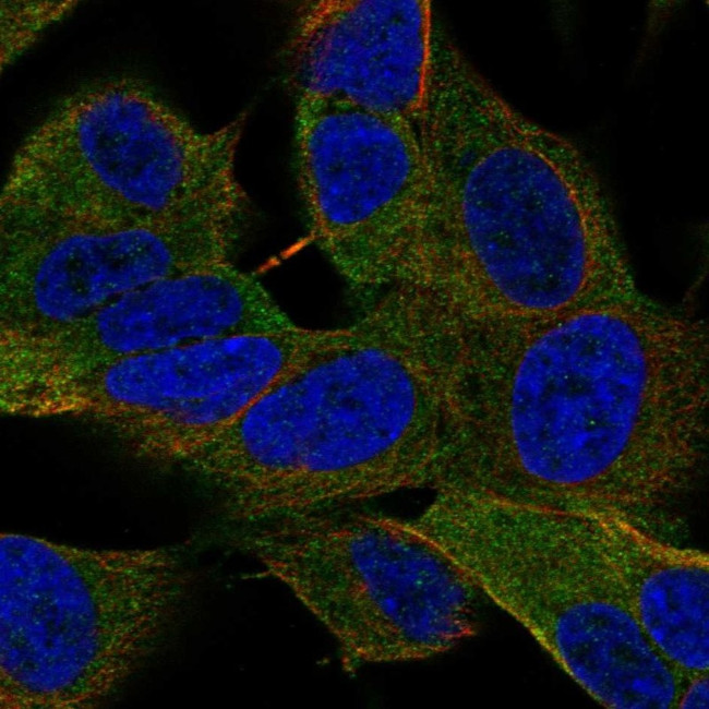 ASAP2 Antibody in Immunocytochemistry (ICC/IF)