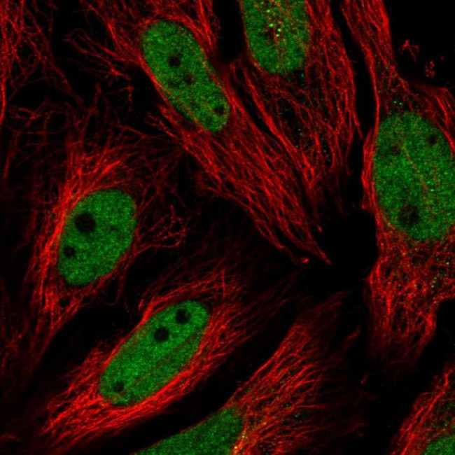 USF1 Antibody in Immunocytochemistry (ICC/IF)