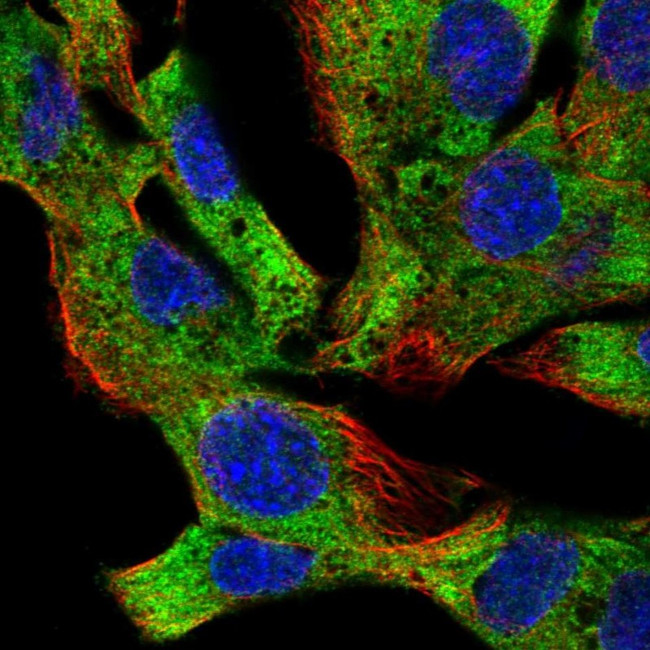EIF2B4 Antibody in Immunocytochemistry (ICC/IF)