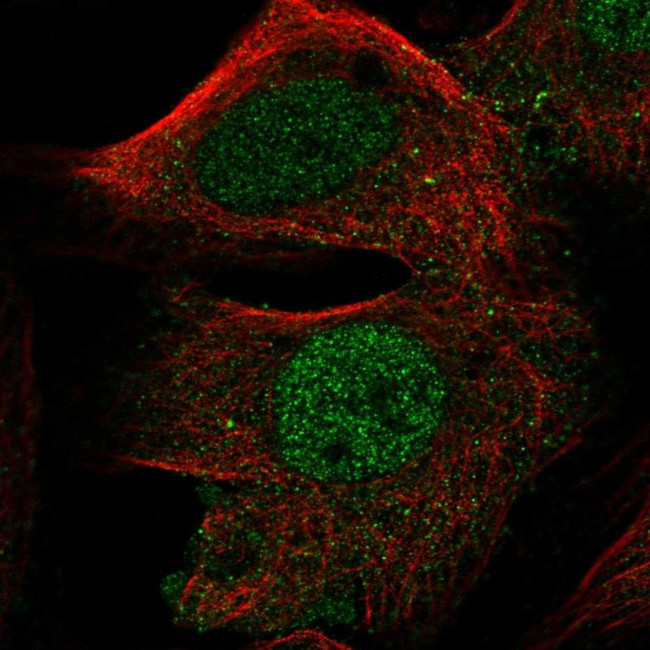 FOXD4L1 Antibody in Immunocytochemistry (ICC/IF)