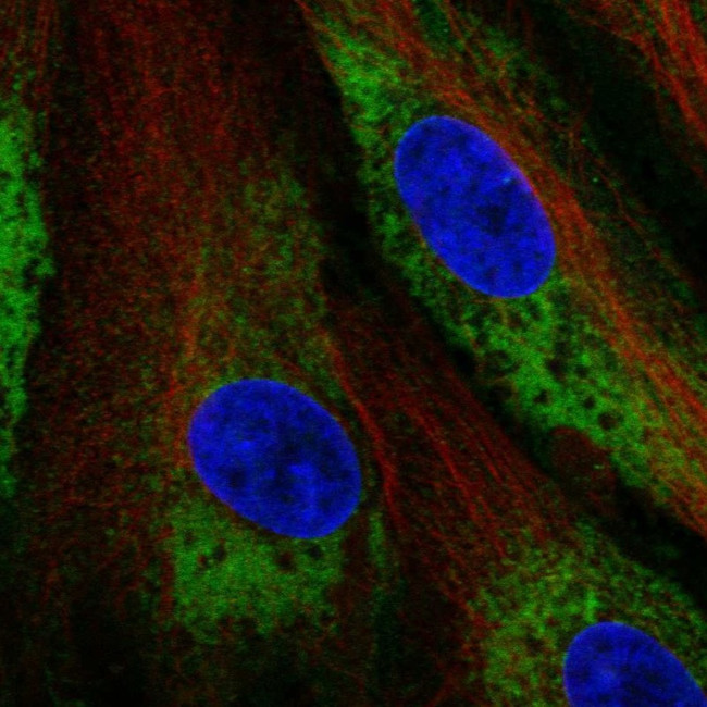 Calumenin Antibody in Immunocytochemistry (ICC/IF)