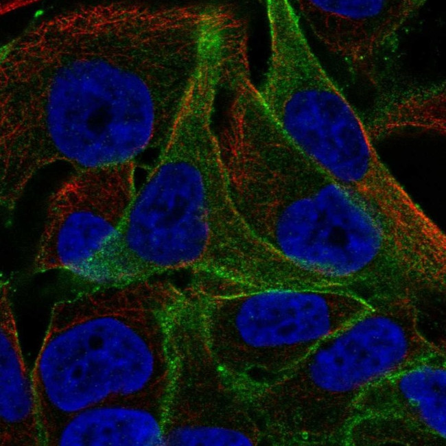 PPFIBP1 Antibody in Immunocytochemistry (ICC/IF)
