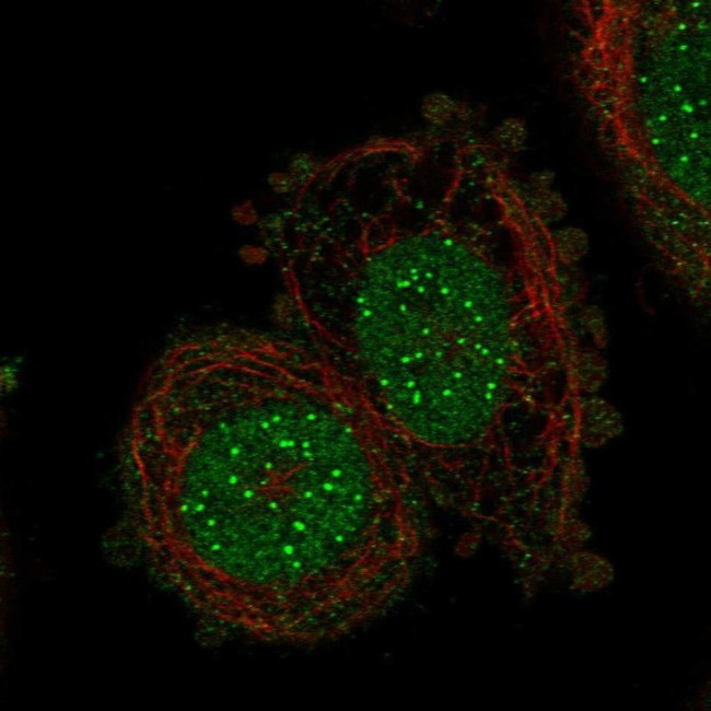 CENPI Antibody in Immunocytochemistry (ICC/IF)