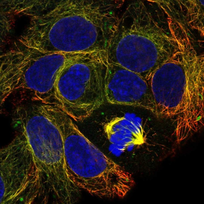 CFAP99 Antibody in Immunocytochemistry (ICC/IF)