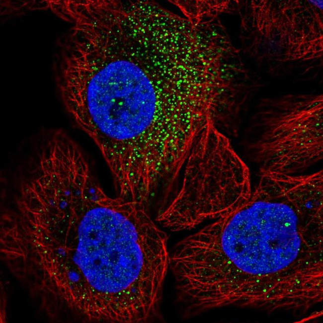 SorCS2 Antibody in Immunocytochemistry (ICC/IF)