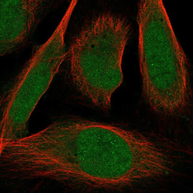 ZMIZ2 Antibody in Immunocytochemistry (ICC/IF)