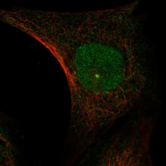 PHF17 Antibody in Immunocytochemistry (ICC/IF)