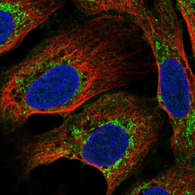 C17orf80 Antibody in Immunocytochemistry (ICC/IF)