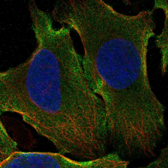 GPATCH1 Antibody in Immunocytochemistry (ICC/IF)