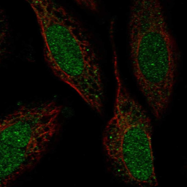 ZNF641 Antibody in Immunocytochemistry (ICC/IF)