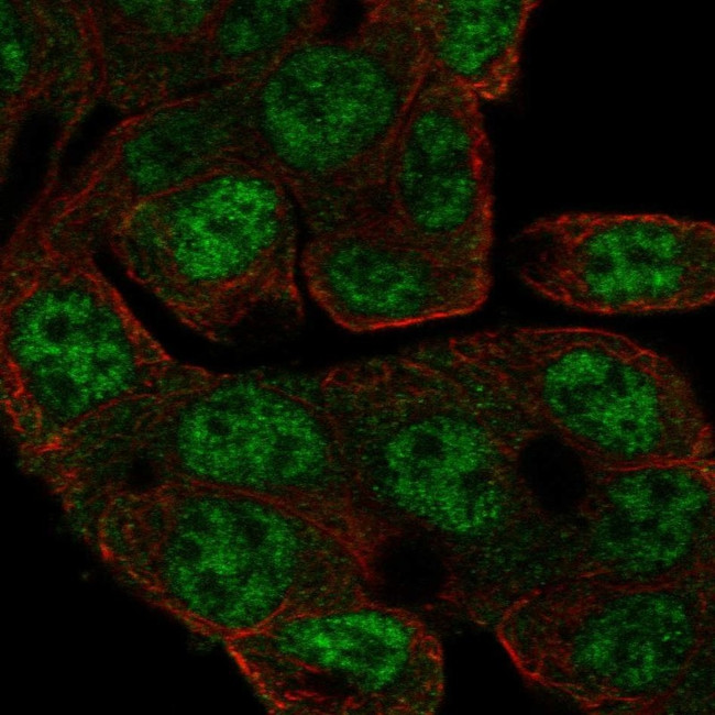 CCDC83 Antibody in Immunocytochemistry (ICC/IF)
