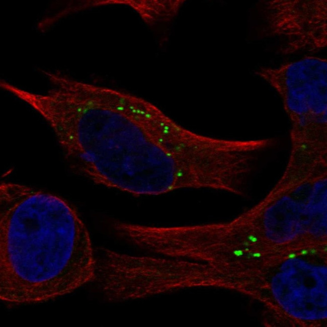 COMMD2 Antibody in Immunocytochemistry (ICC/IF)