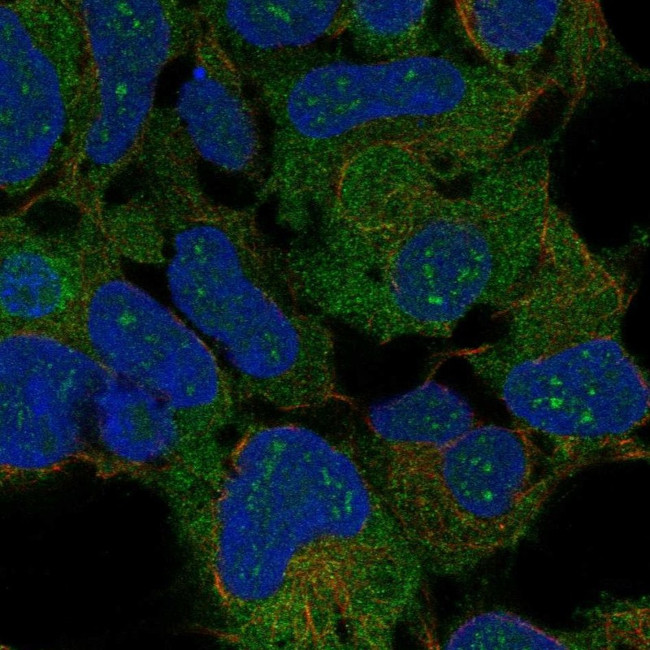 RPLP2 Antibody in Immunocytochemistry (ICC/IF)