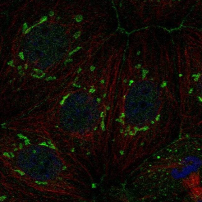FAM222A Antibody in Immunocytochemistry (ICC/IF)