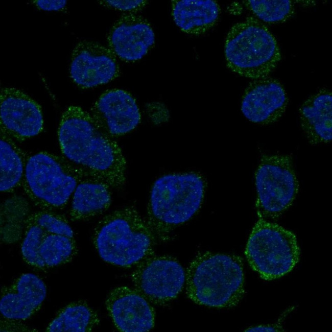 ANKRD30BL Antibody in Immunocytochemistry (ICC/IF)