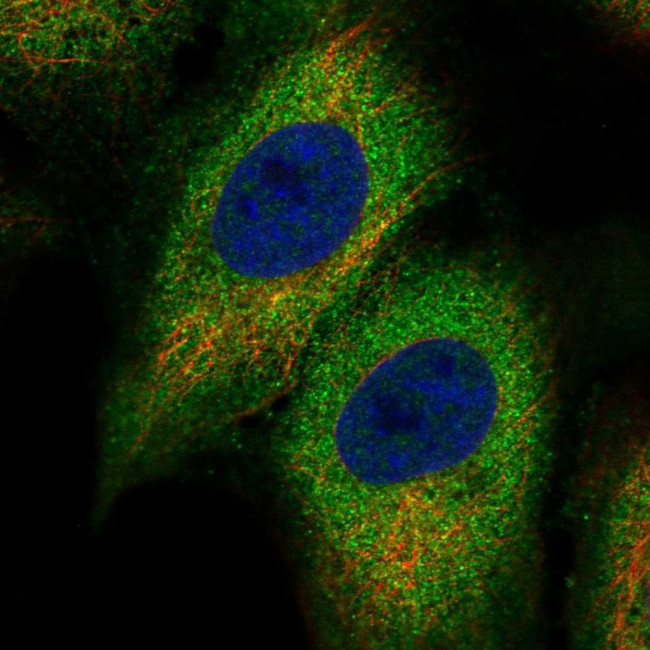 KV1.6 (KCNA6) Antibody in Immunocytochemistry (ICC/IF)