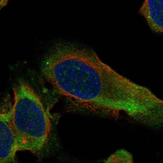 RPL10A Antibody in Immunocytochemistry (ICC/IF)