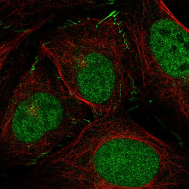ZNF469 Antibody in Immunocytochemistry (ICC/IF)