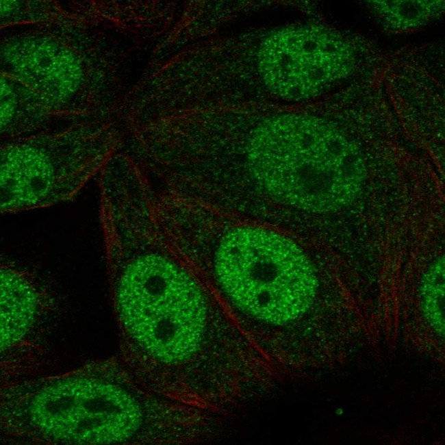 NHLRC1 Antibody in Immunocytochemistry (ICC/IF)