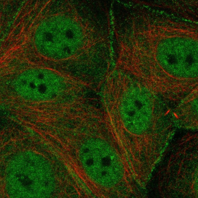 TMPRSS13 Antibody in Immunocytochemistry (ICC/IF)